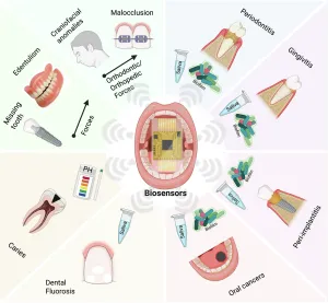 Biosensors in Dental, Oral and Craniofacial Applications