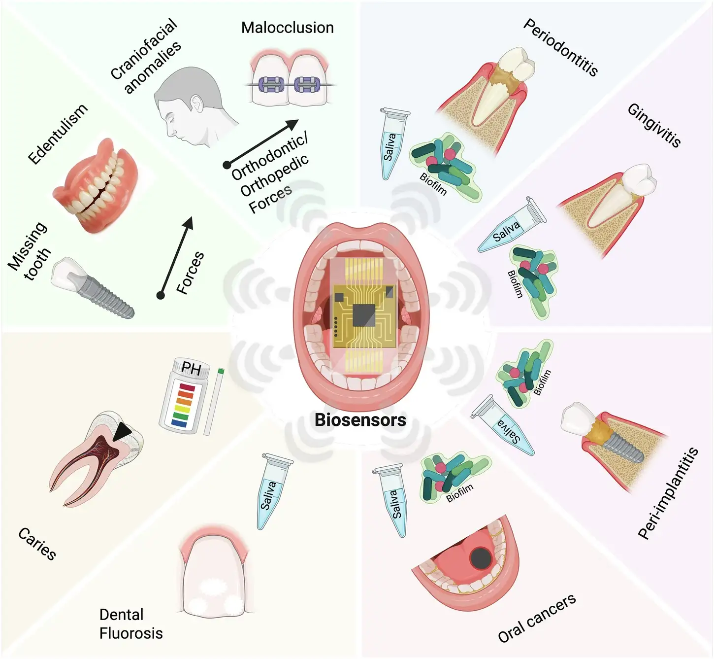 Biosensors in Dental, Oral and Craniofacial Applications